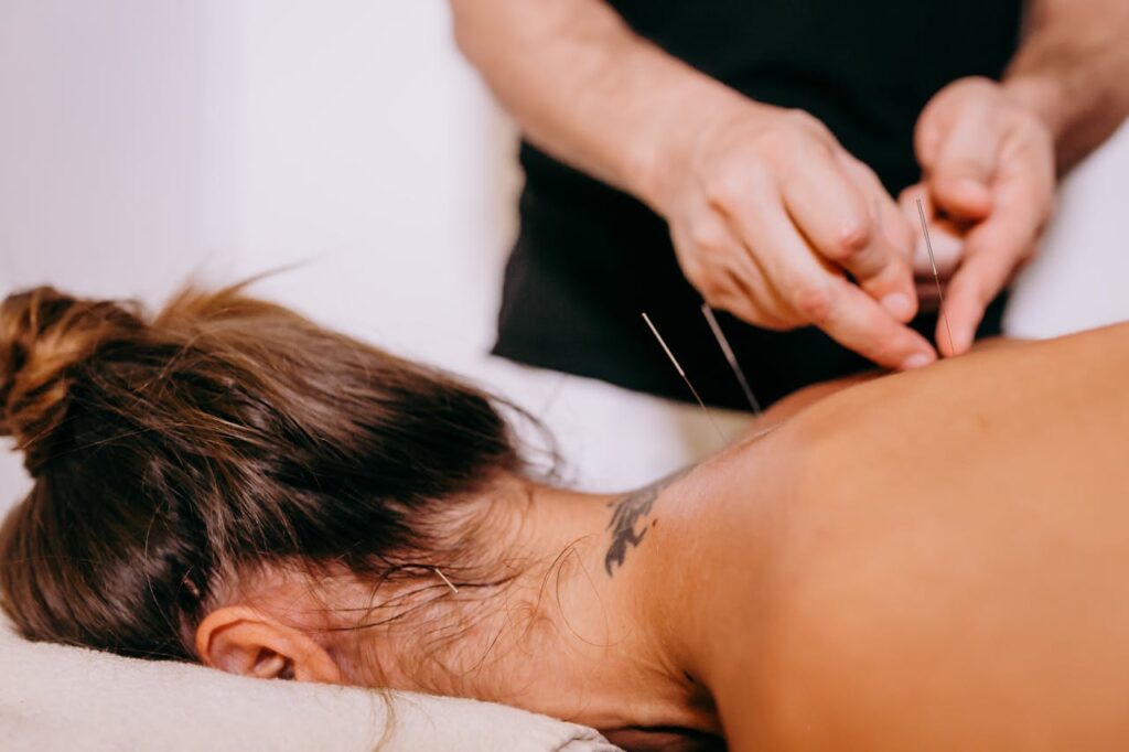 pexels-photo-4353249 Close-up of acupuncture needles being inserted on a woman's back during therapy, promoting relaxation and wellness.